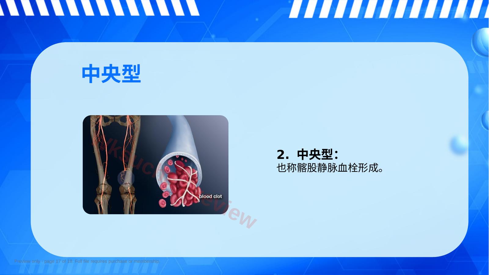 预览第 17 页