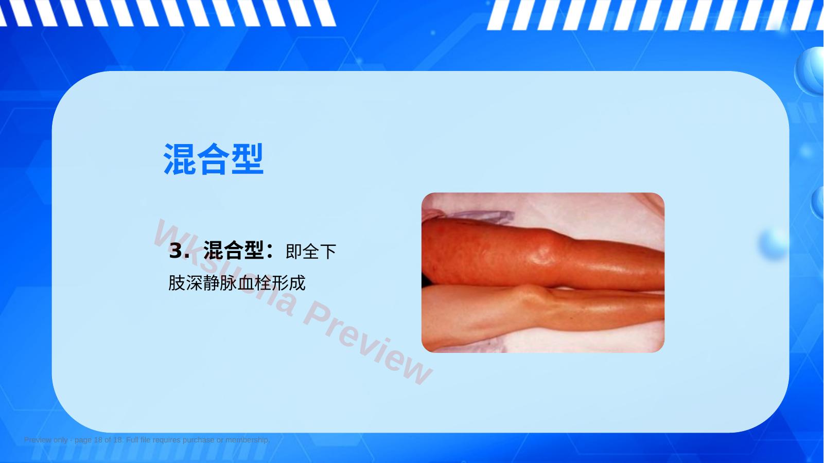预览第 18 页