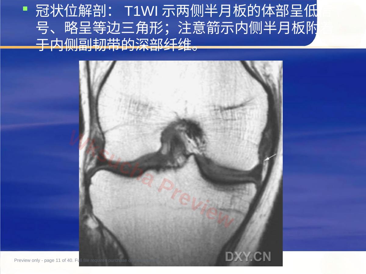 预览第 11 页