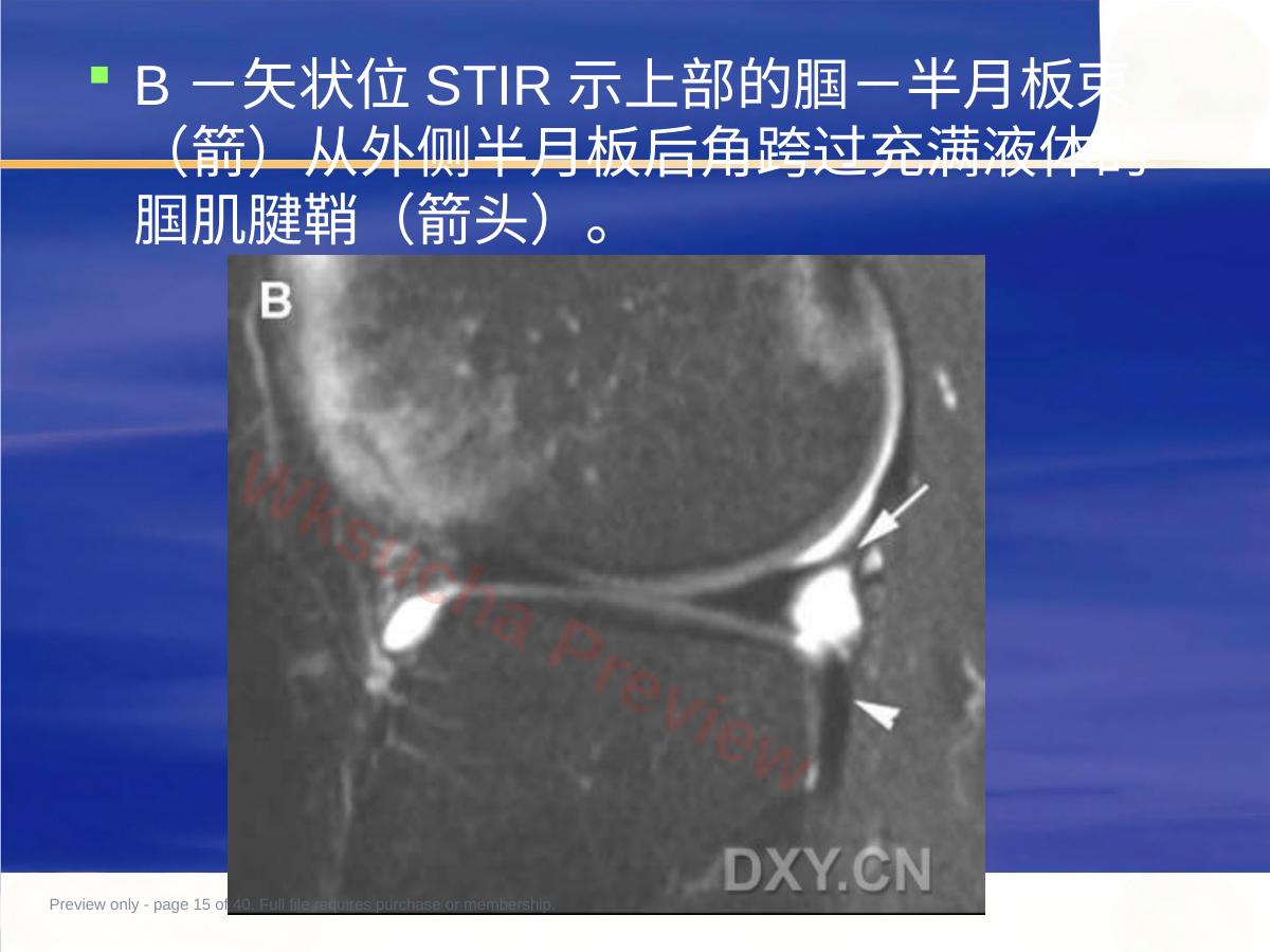 预览第 15 页