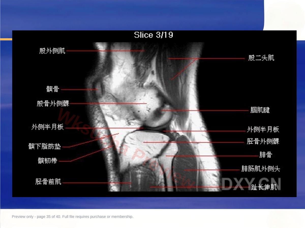 预览第 35 页