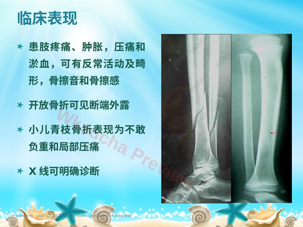 预览第 12 页