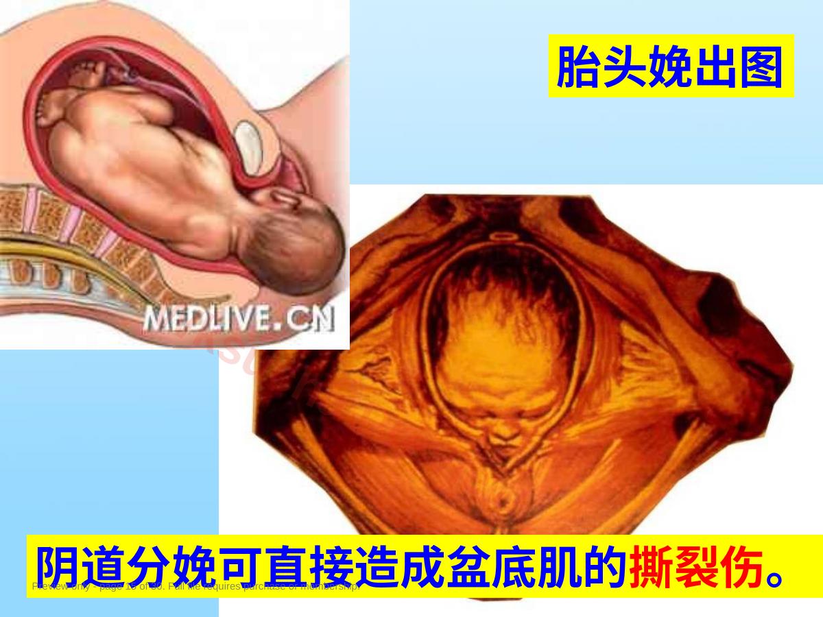 预览第 15 页
