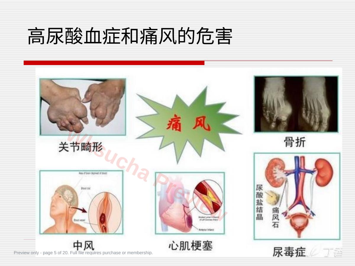 预览第 5 页