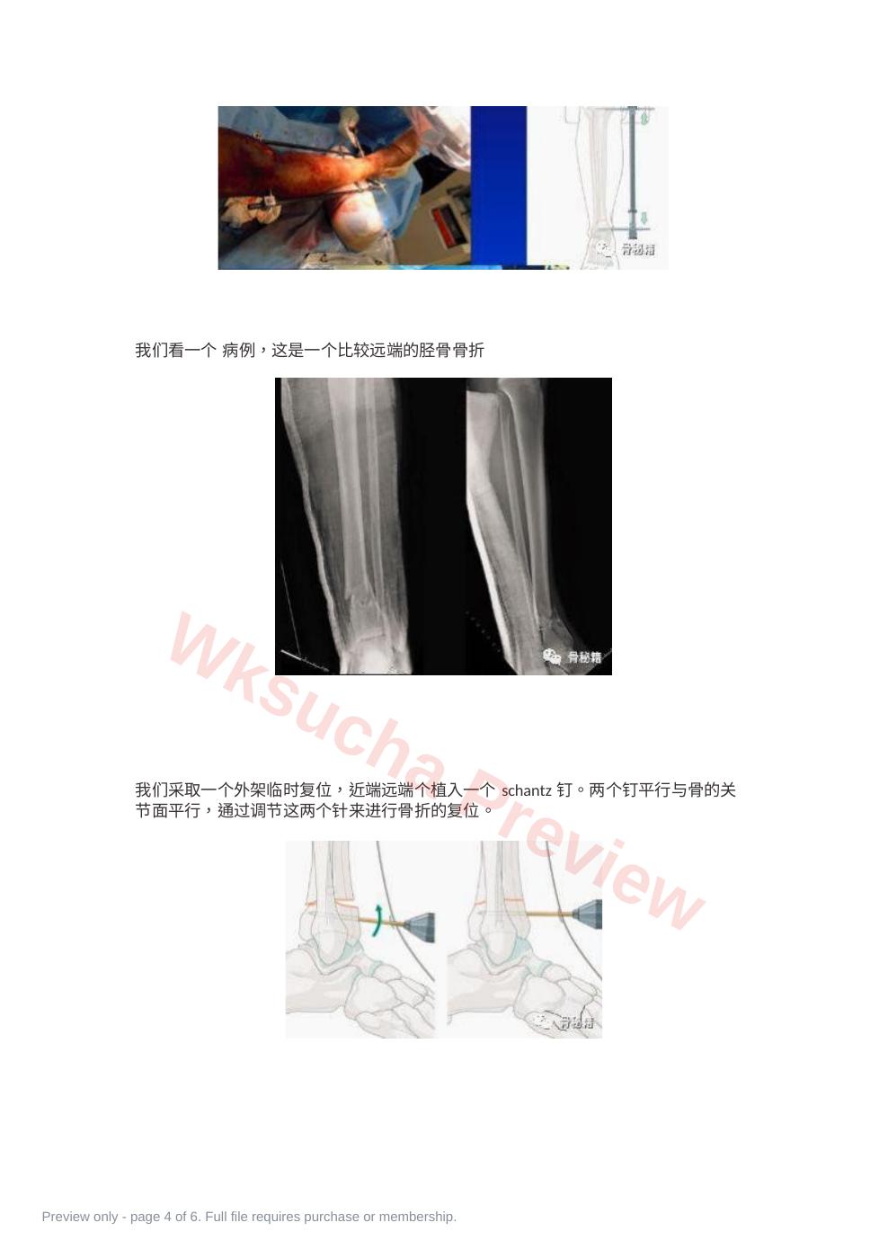 预览第 4 页