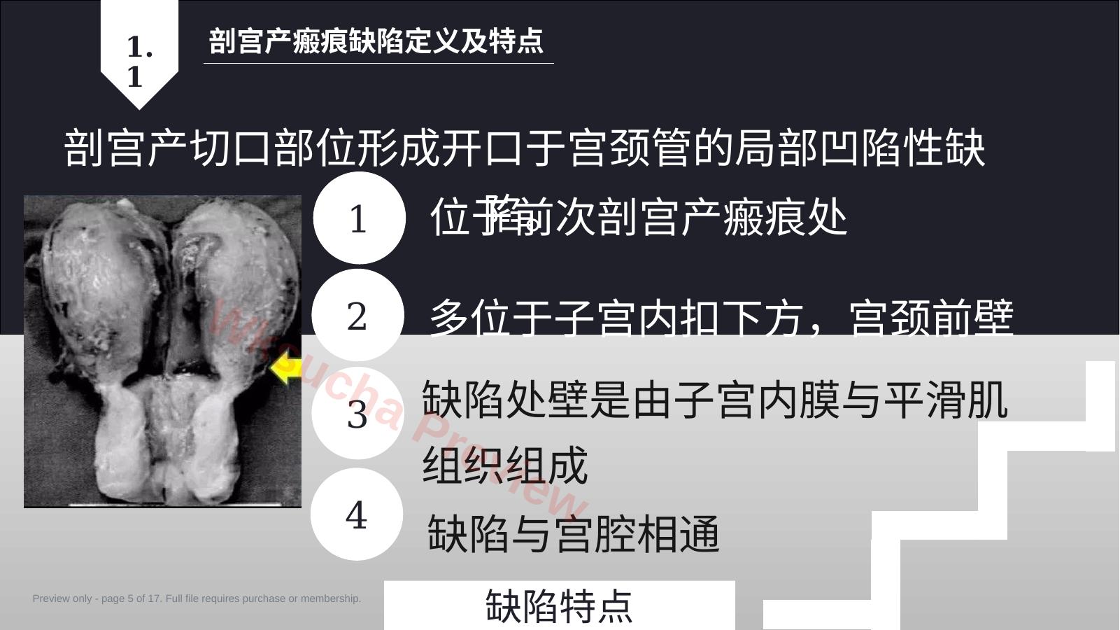 预览第 5 页