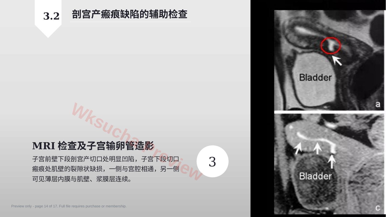 预览第 14 页
