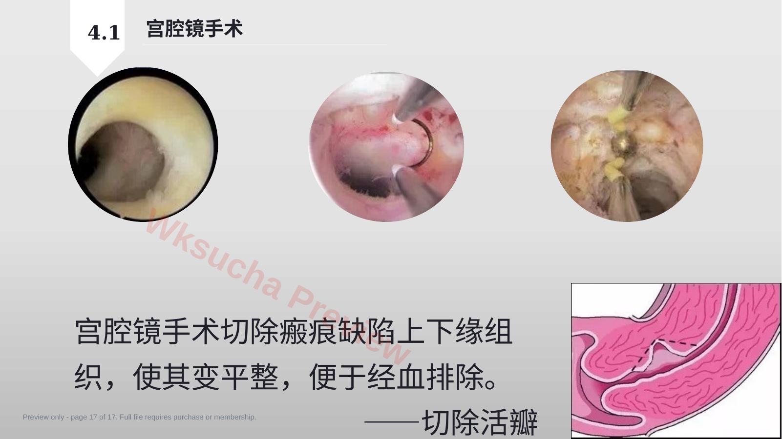 预览第 17 页