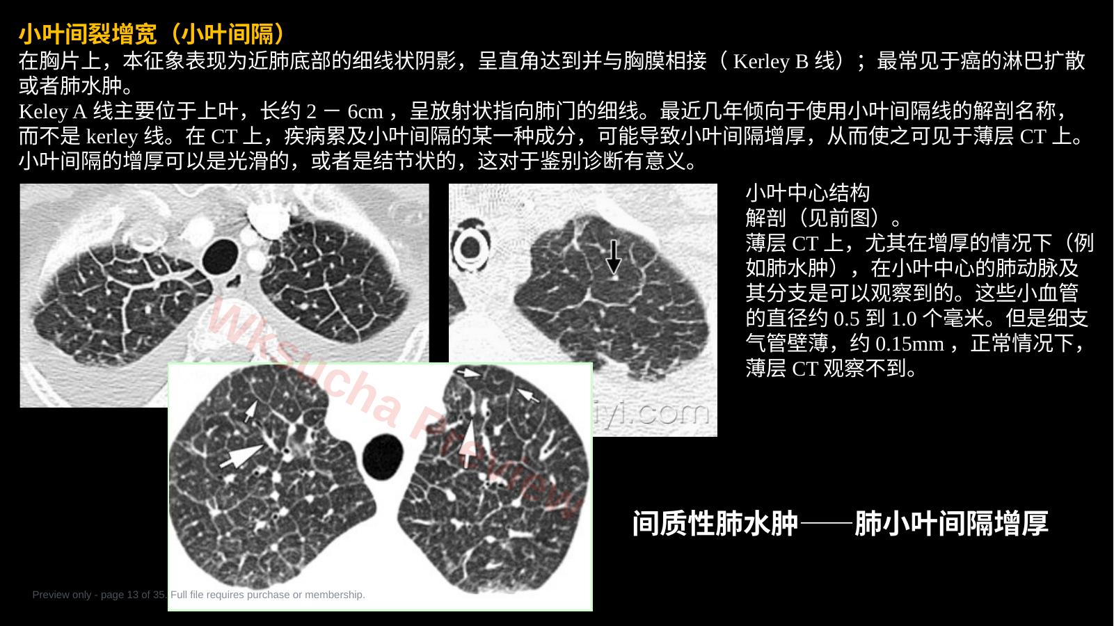 预览第 13 页