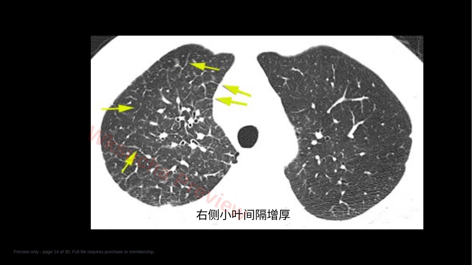 预览第 14 页