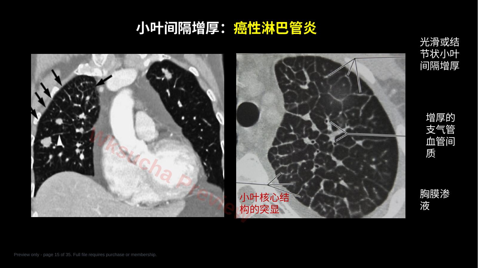 预览第 15 页