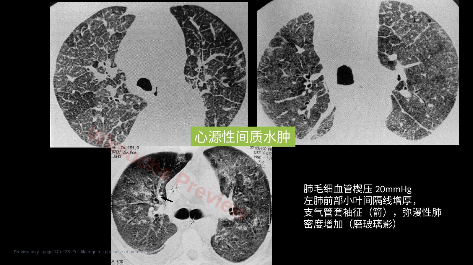 预览第 17 页