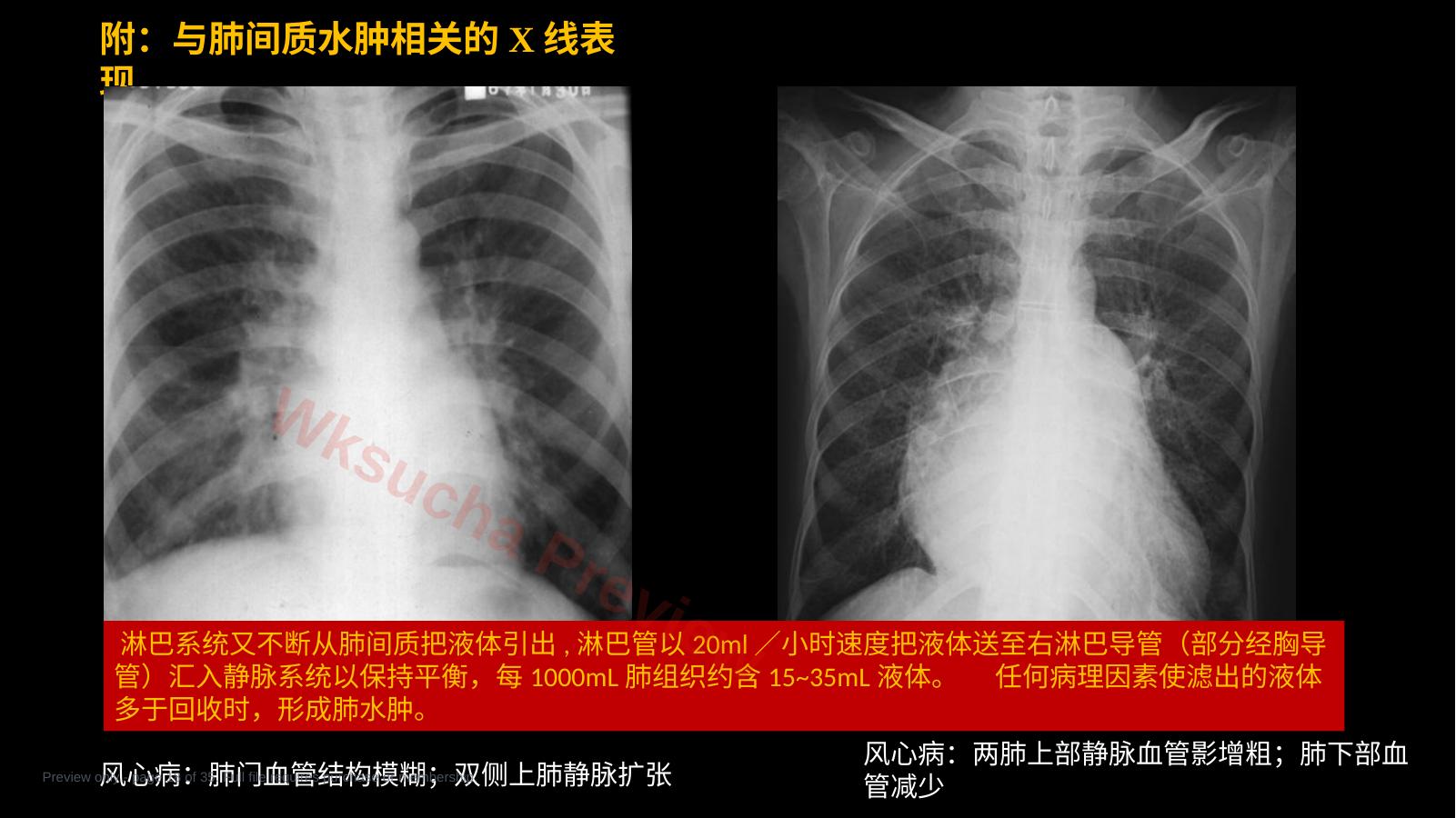 预览第 18 页
