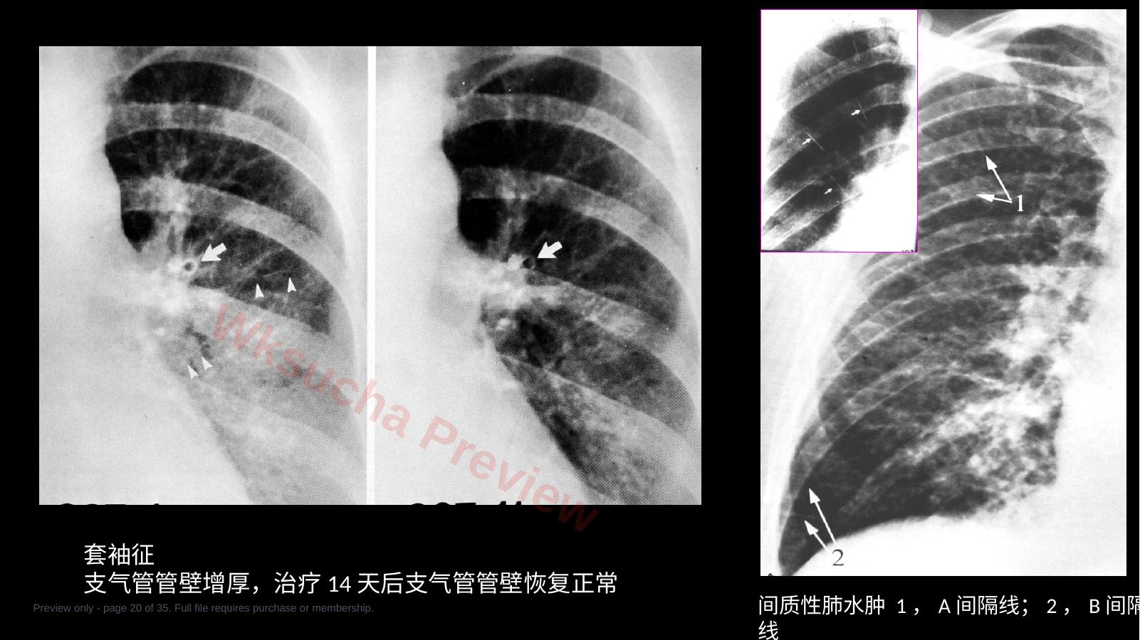 预览第 20 页