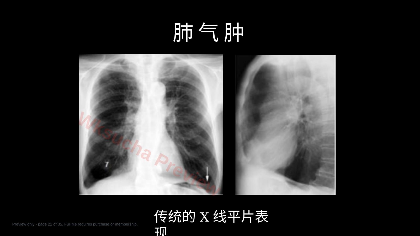 预览第 21 页