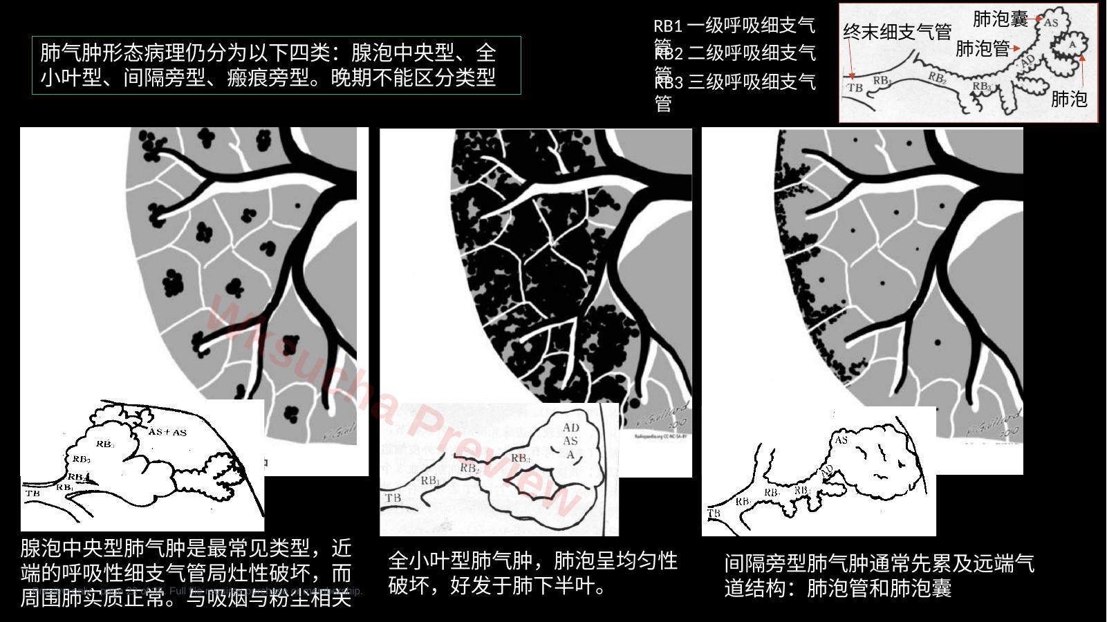 预览第 22 页