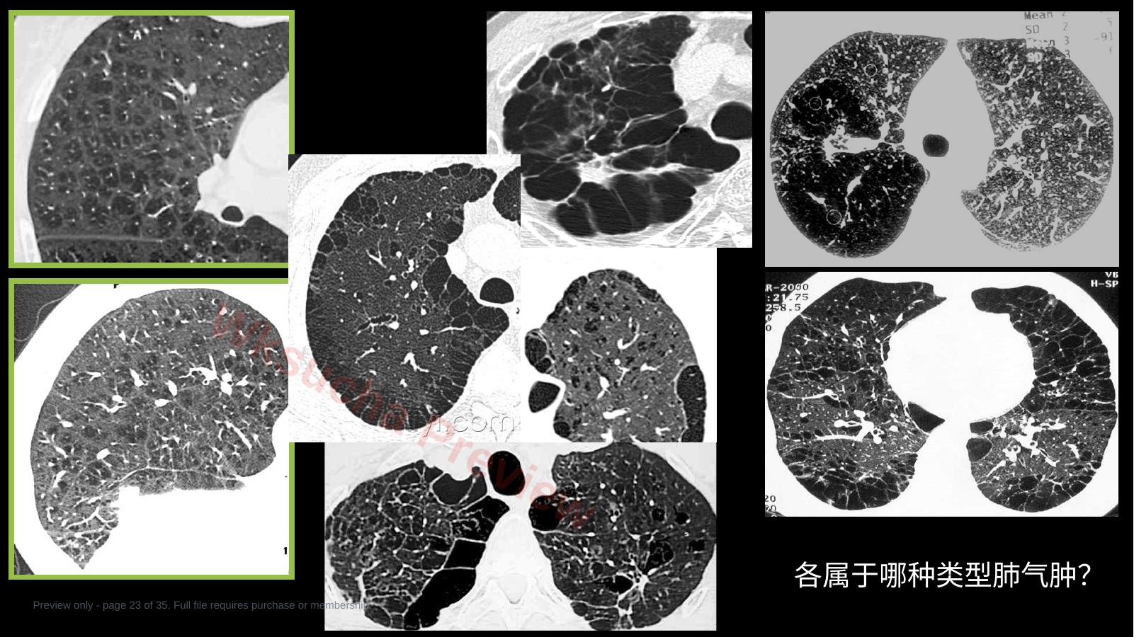 预览第 23 页