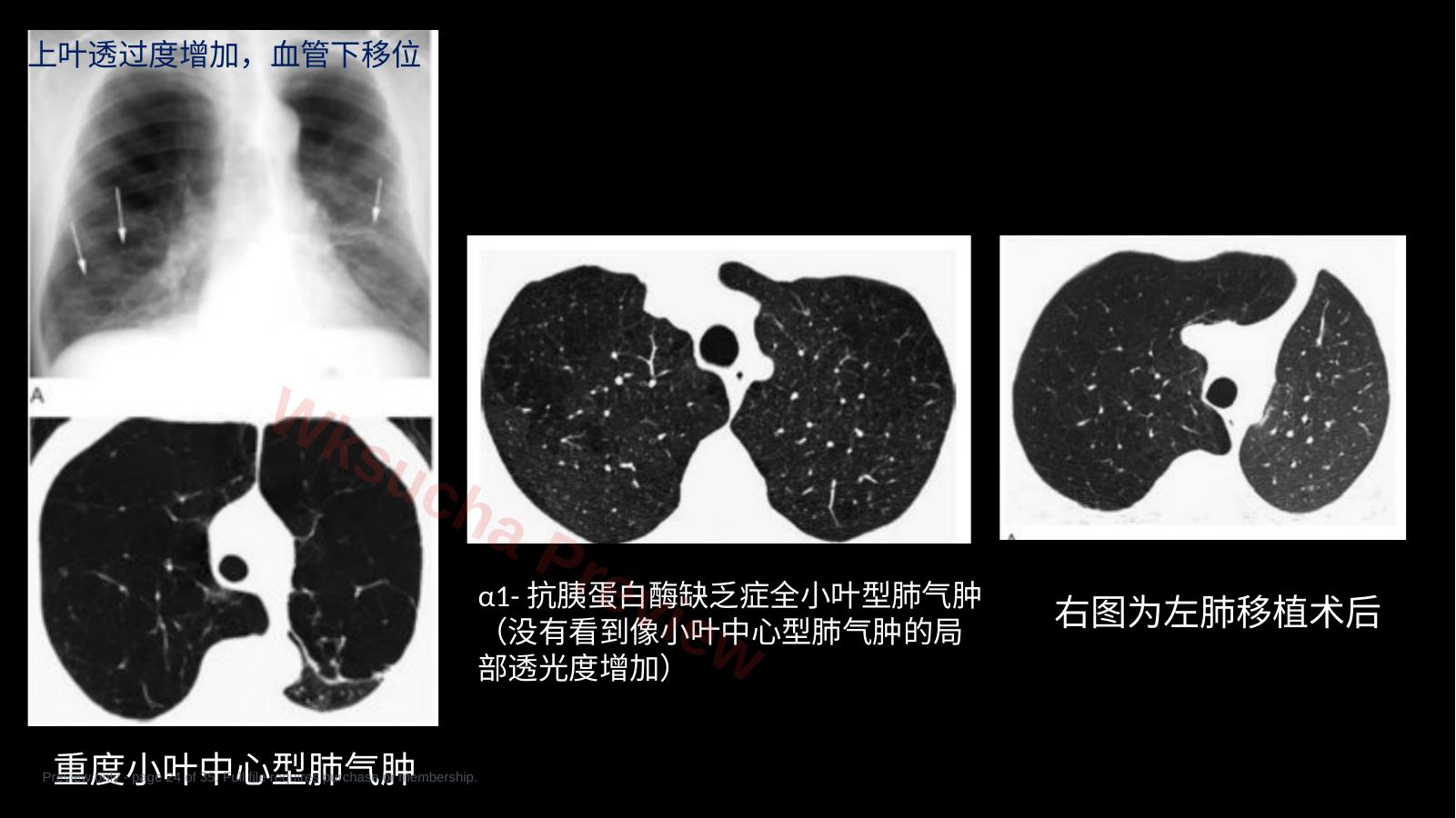 预览第 24 页