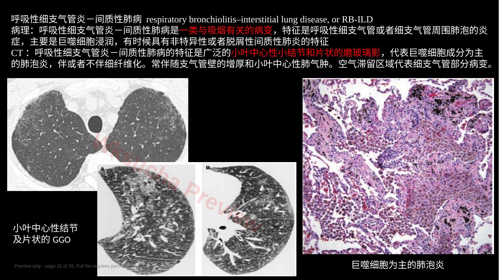 预览第 31 页