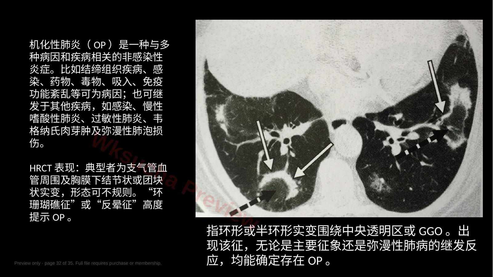 预览第 32 页