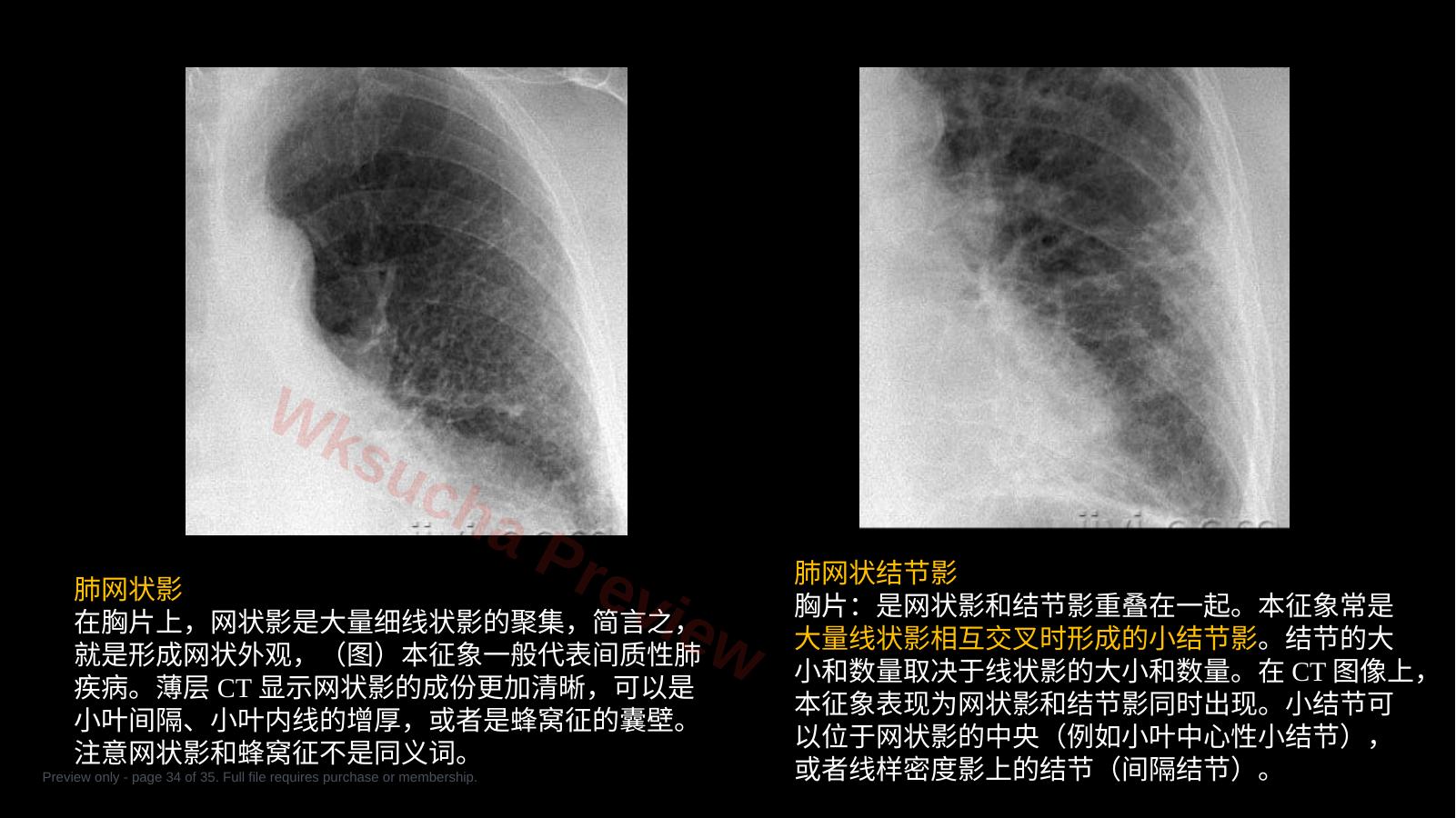 预览第 34 页