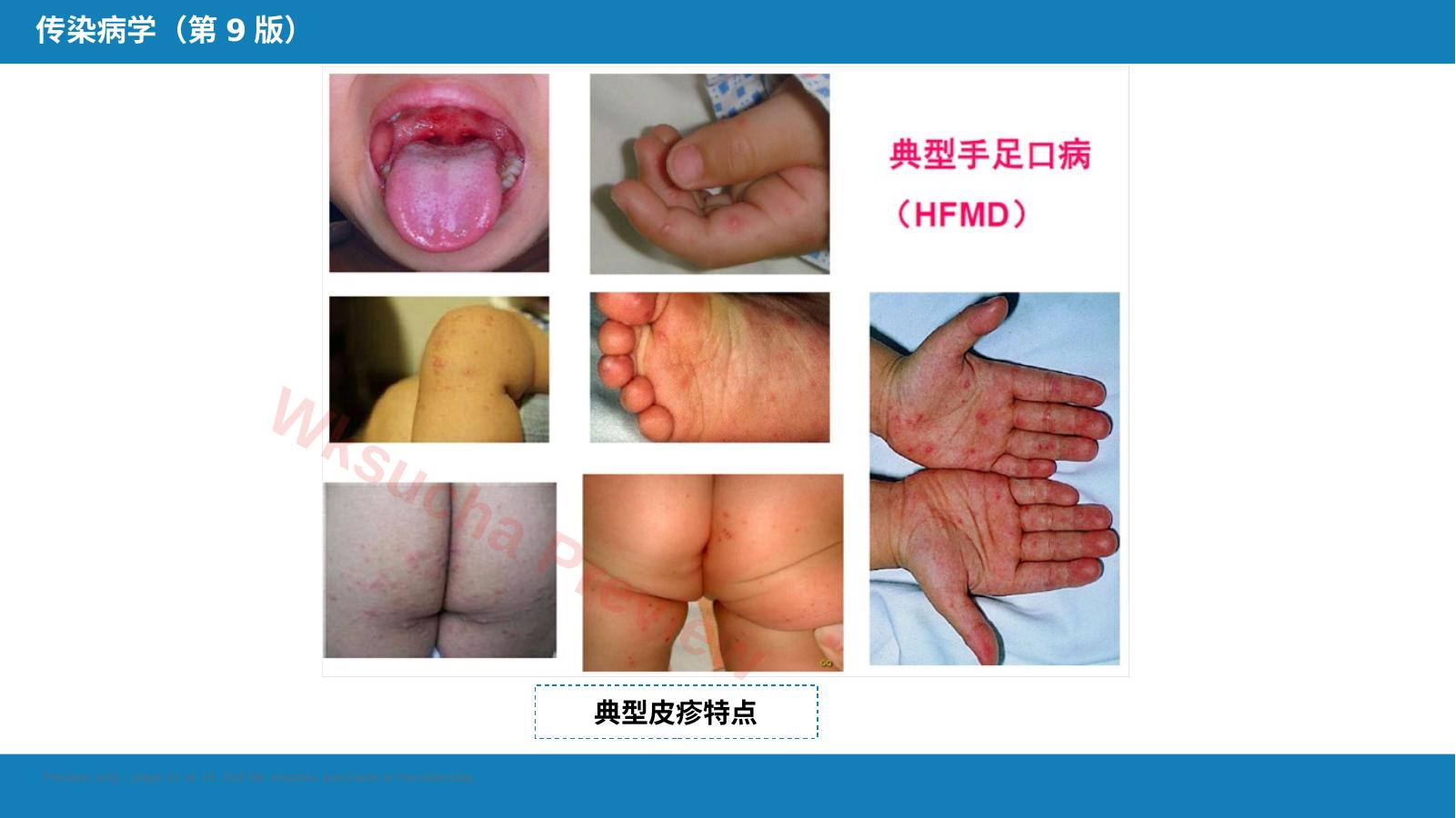 预览第 11 页