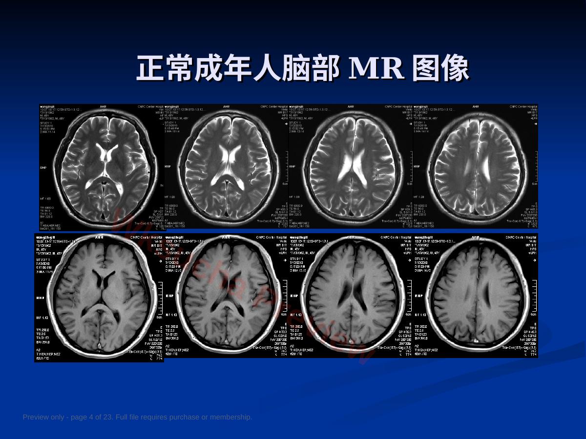 预览第 4 页