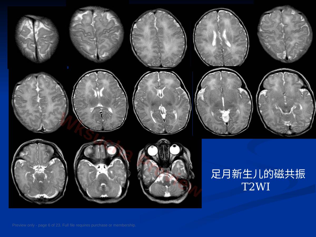预览第 6 页
