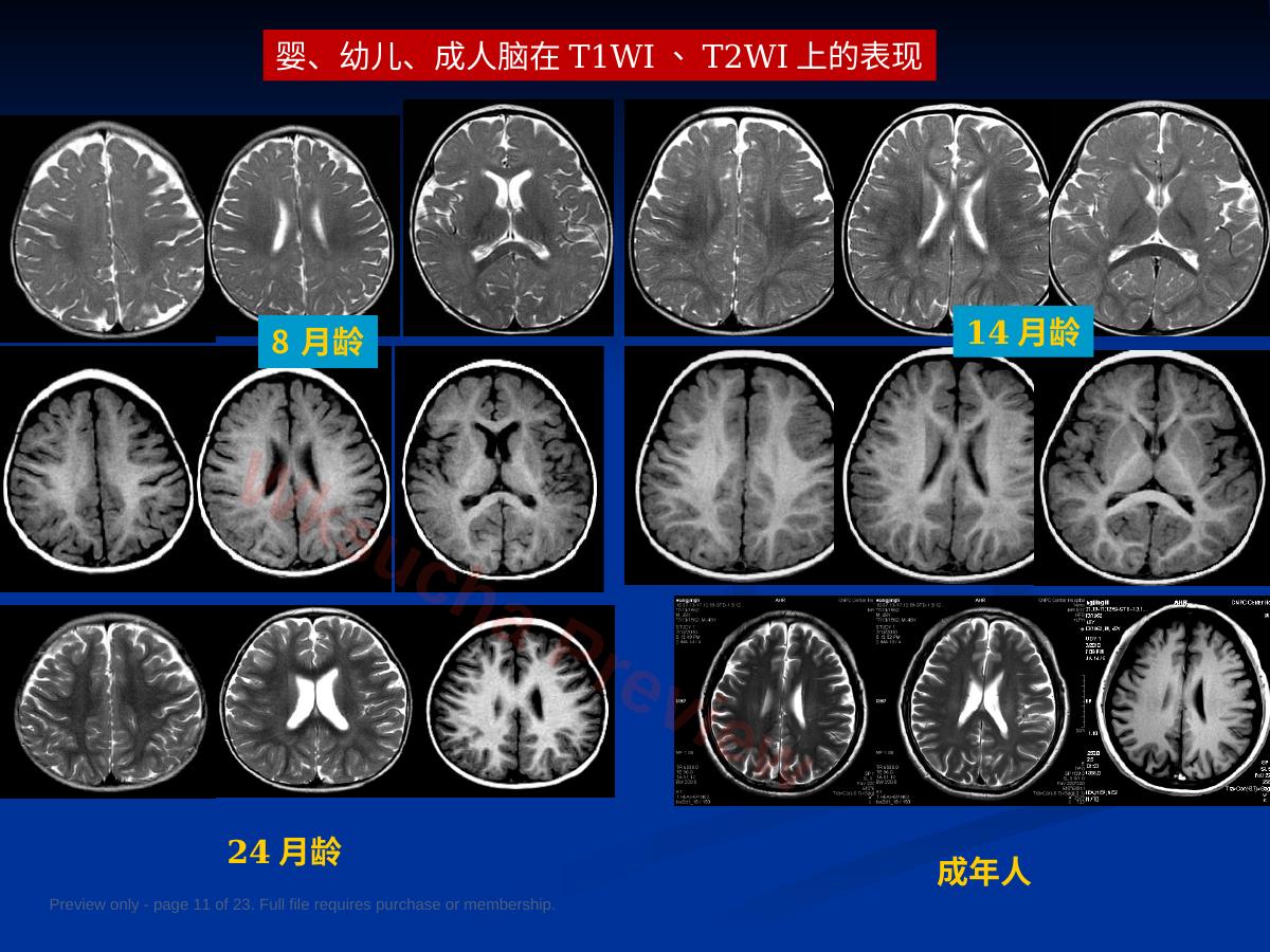 预览第 11 页