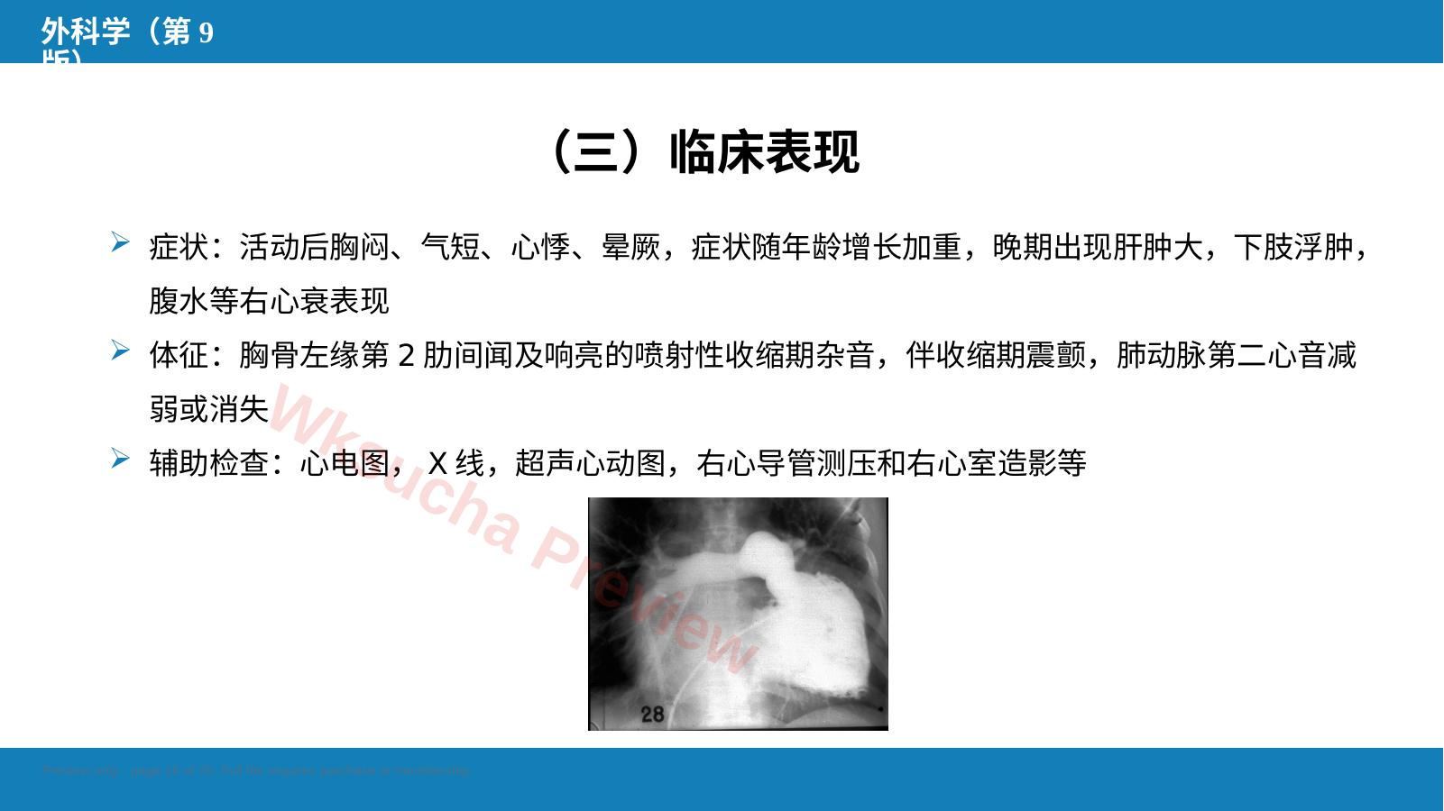预览第 16 页