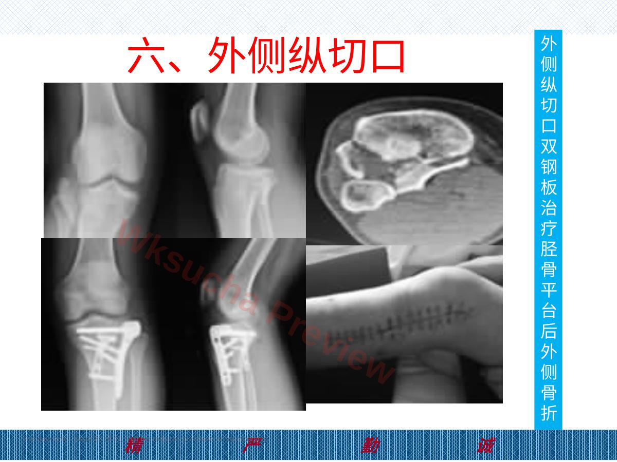 预览第 32 页