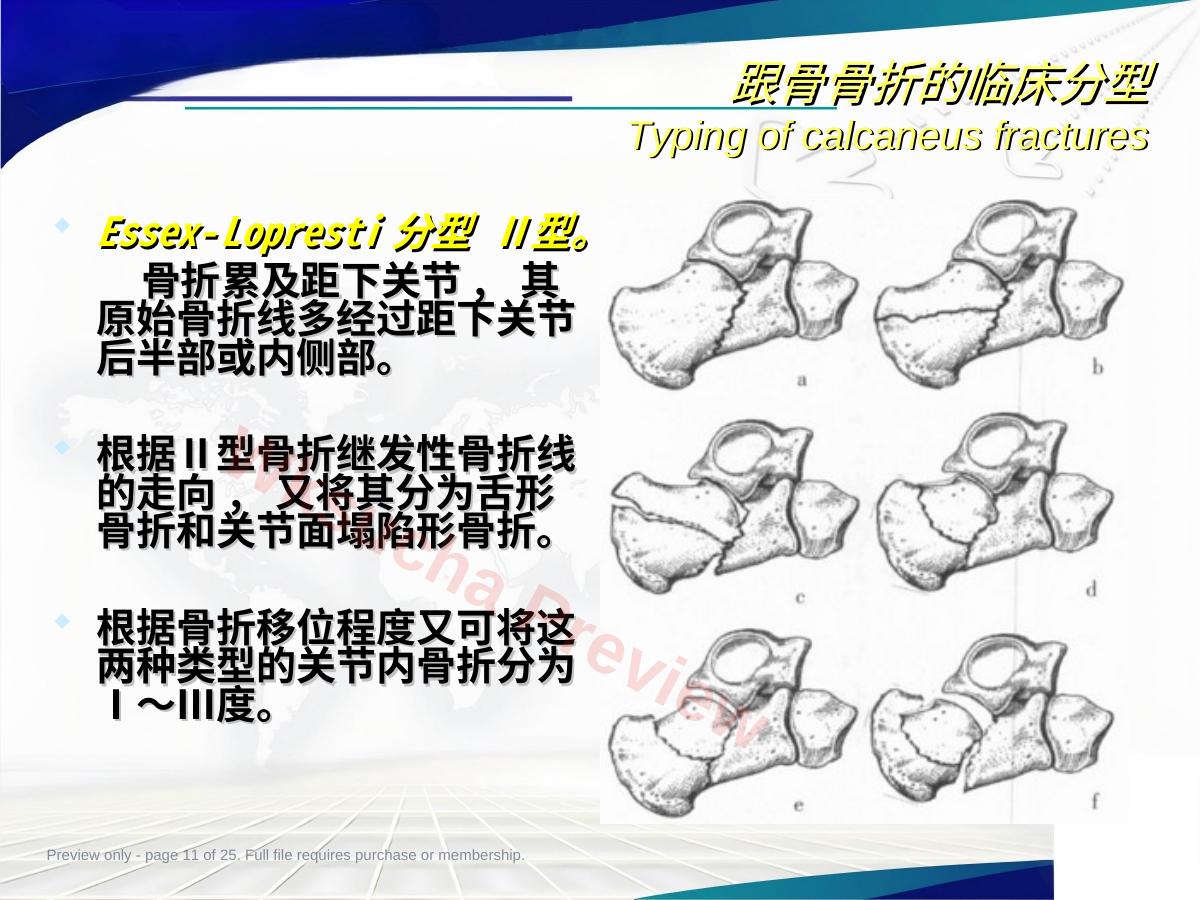预览第 11 页