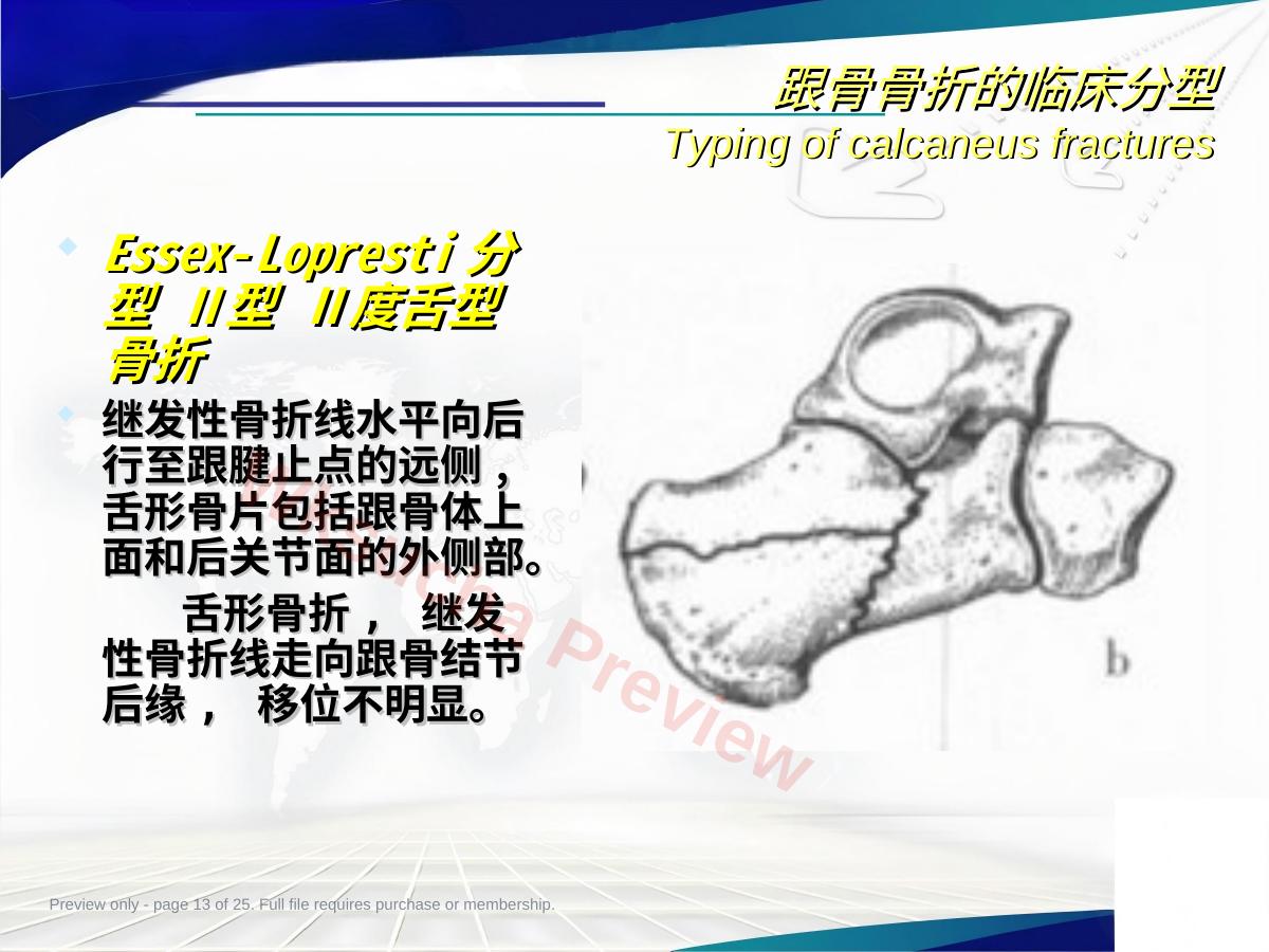 预览第 13 页