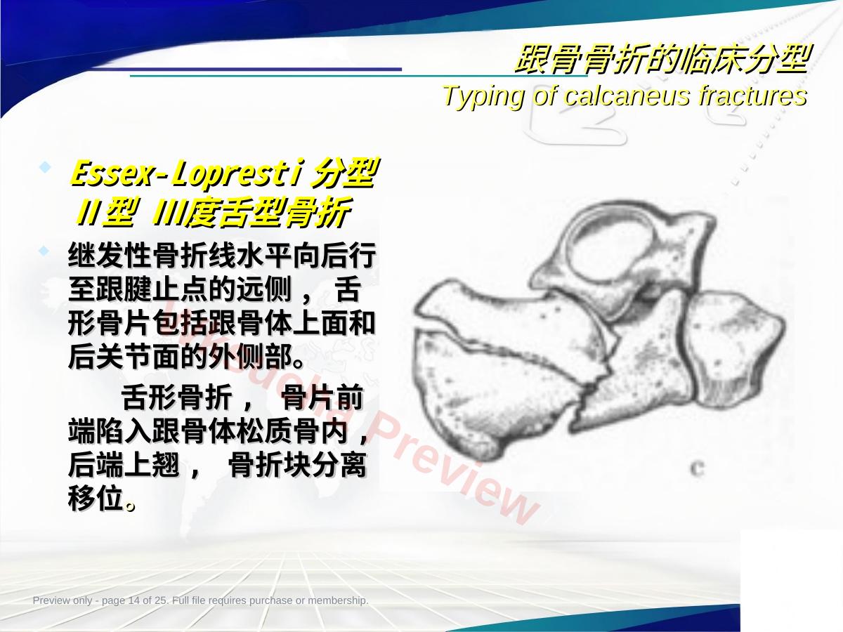 预览第 14 页