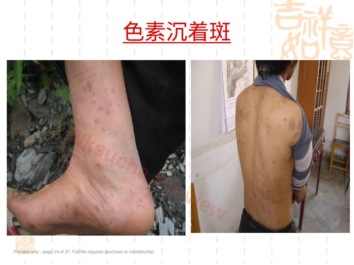预览第 14 页