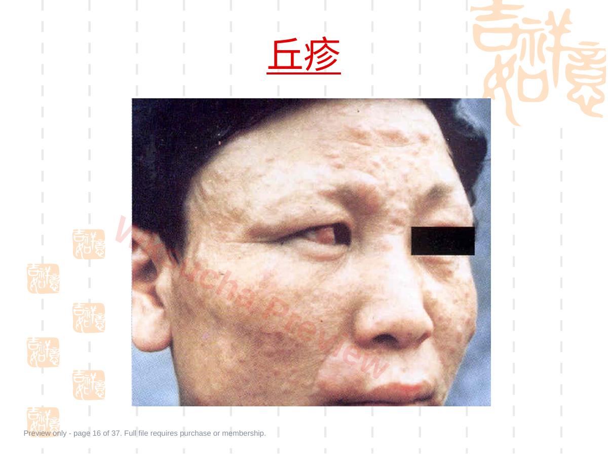 预览第 16 页
