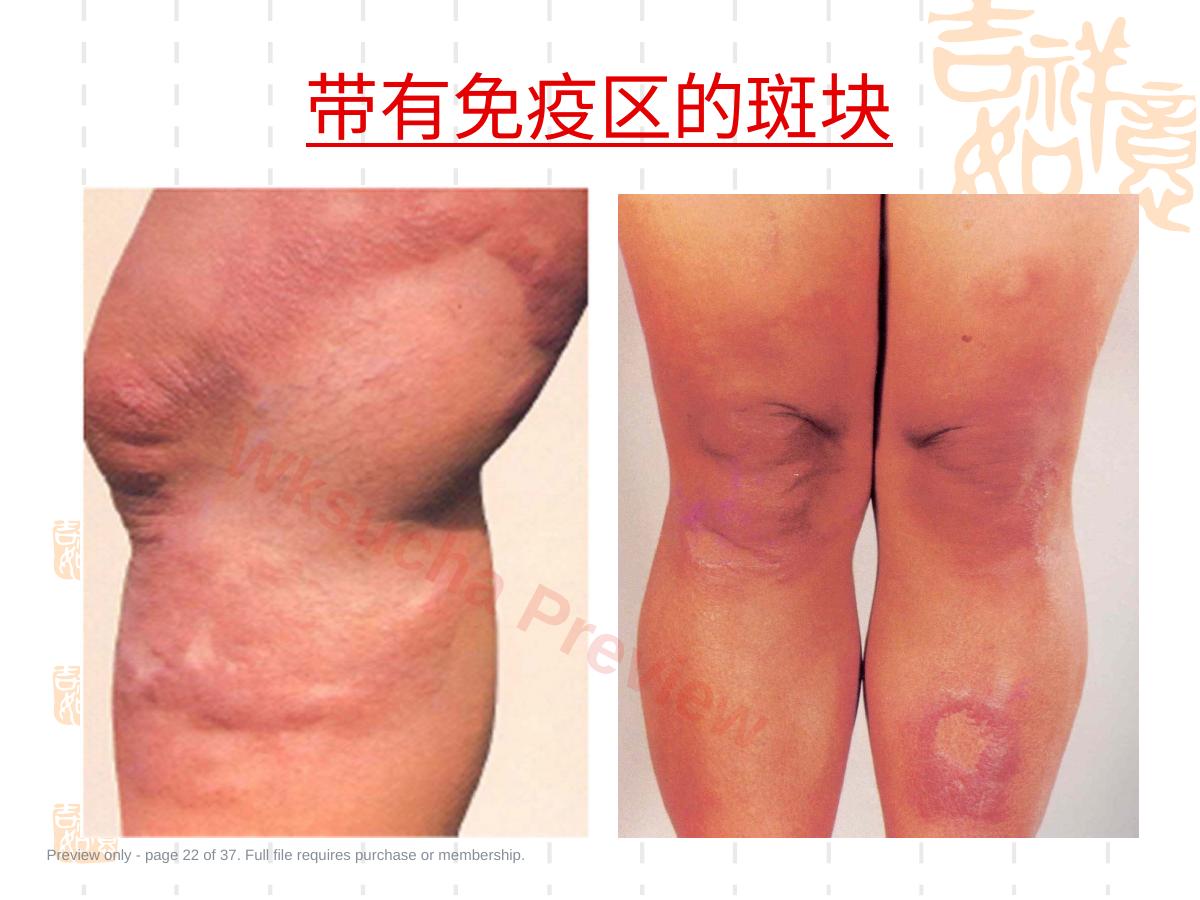 预览第 22 页