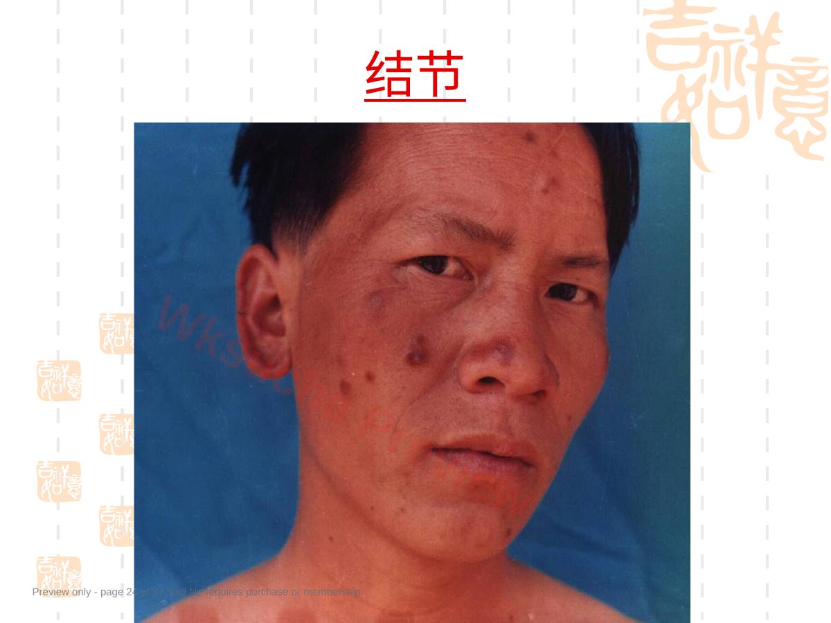 预览第 24 页