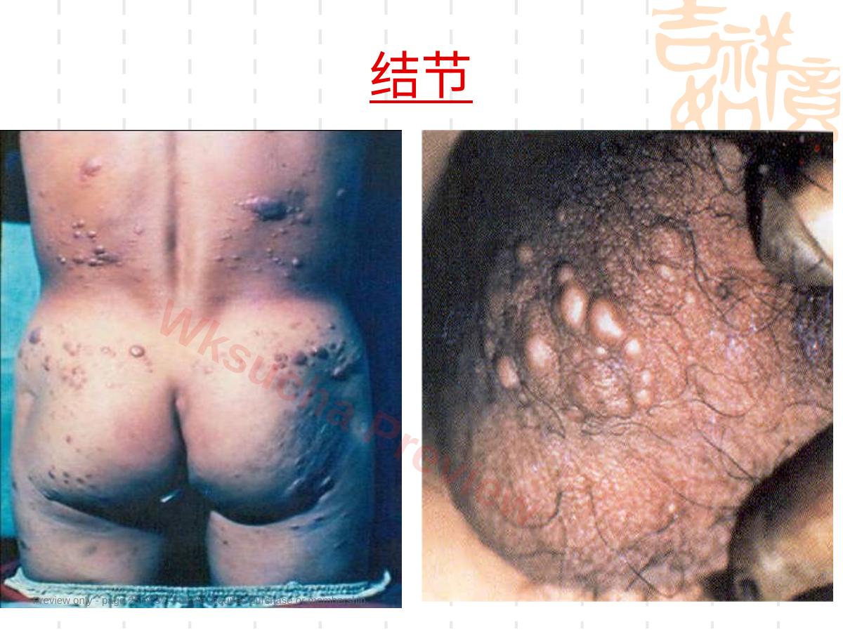 预览第 25 页