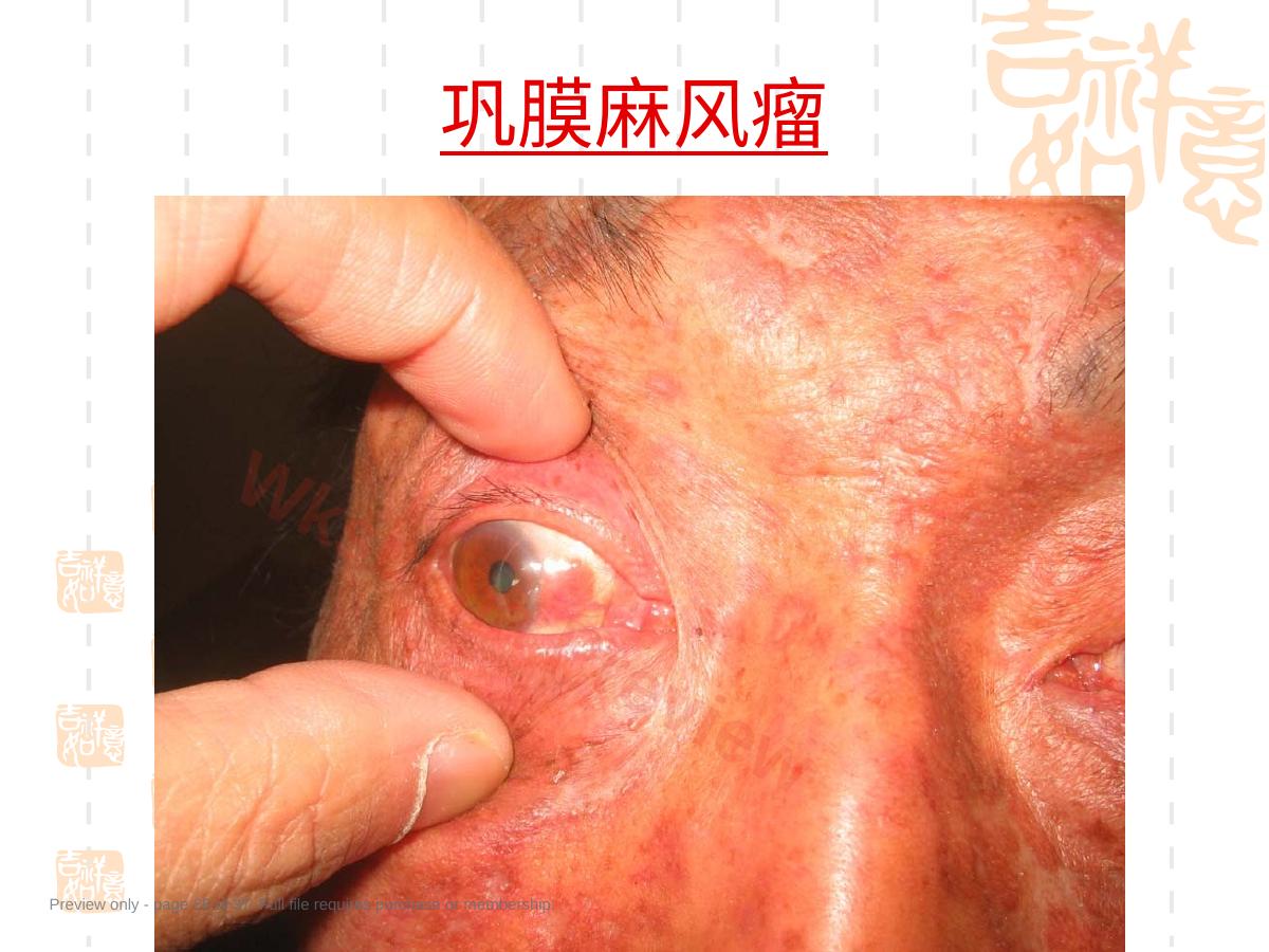 预览第 28 页