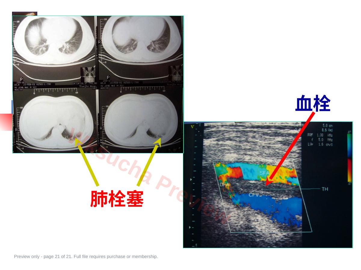 预览第 21 页