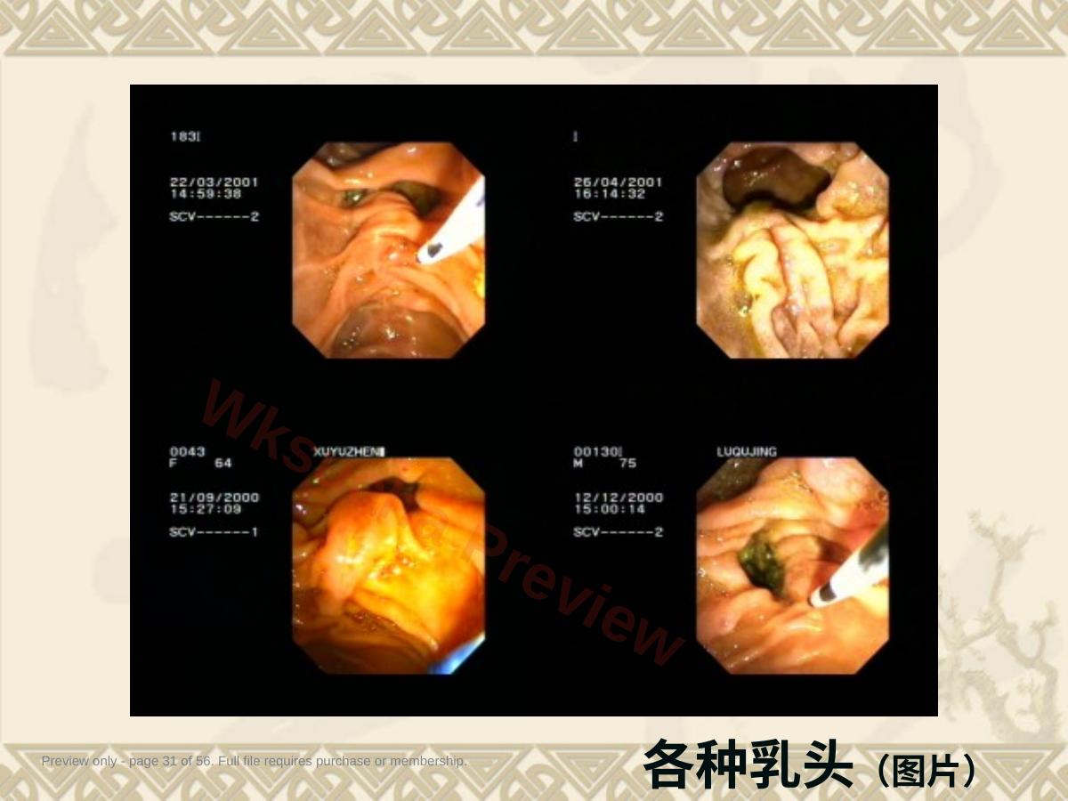 预览第 31 页