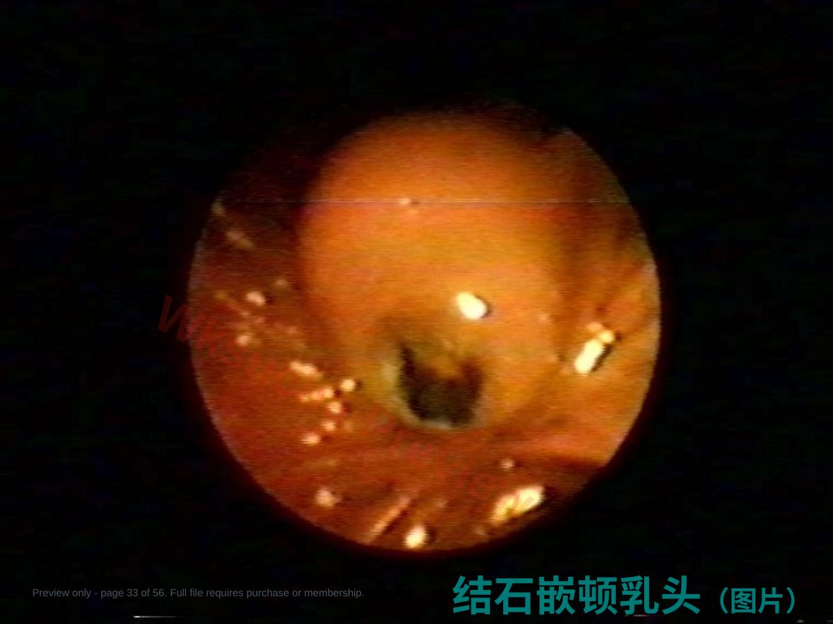 预览第 33 页