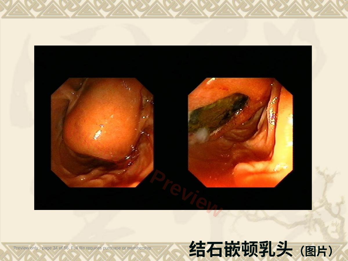 预览第 34 页