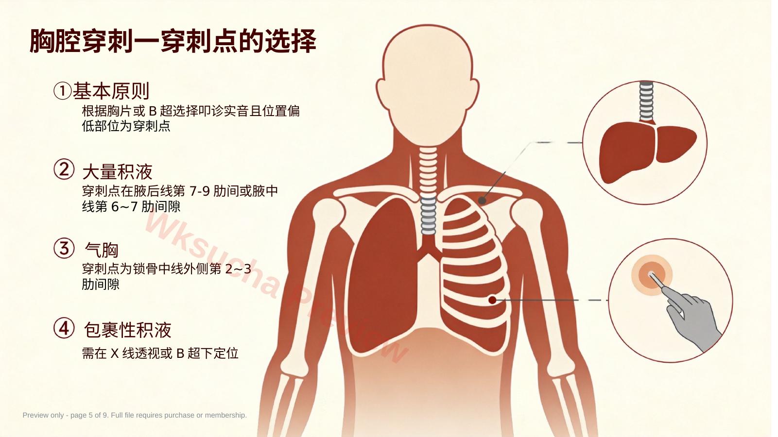 预览第 5 页