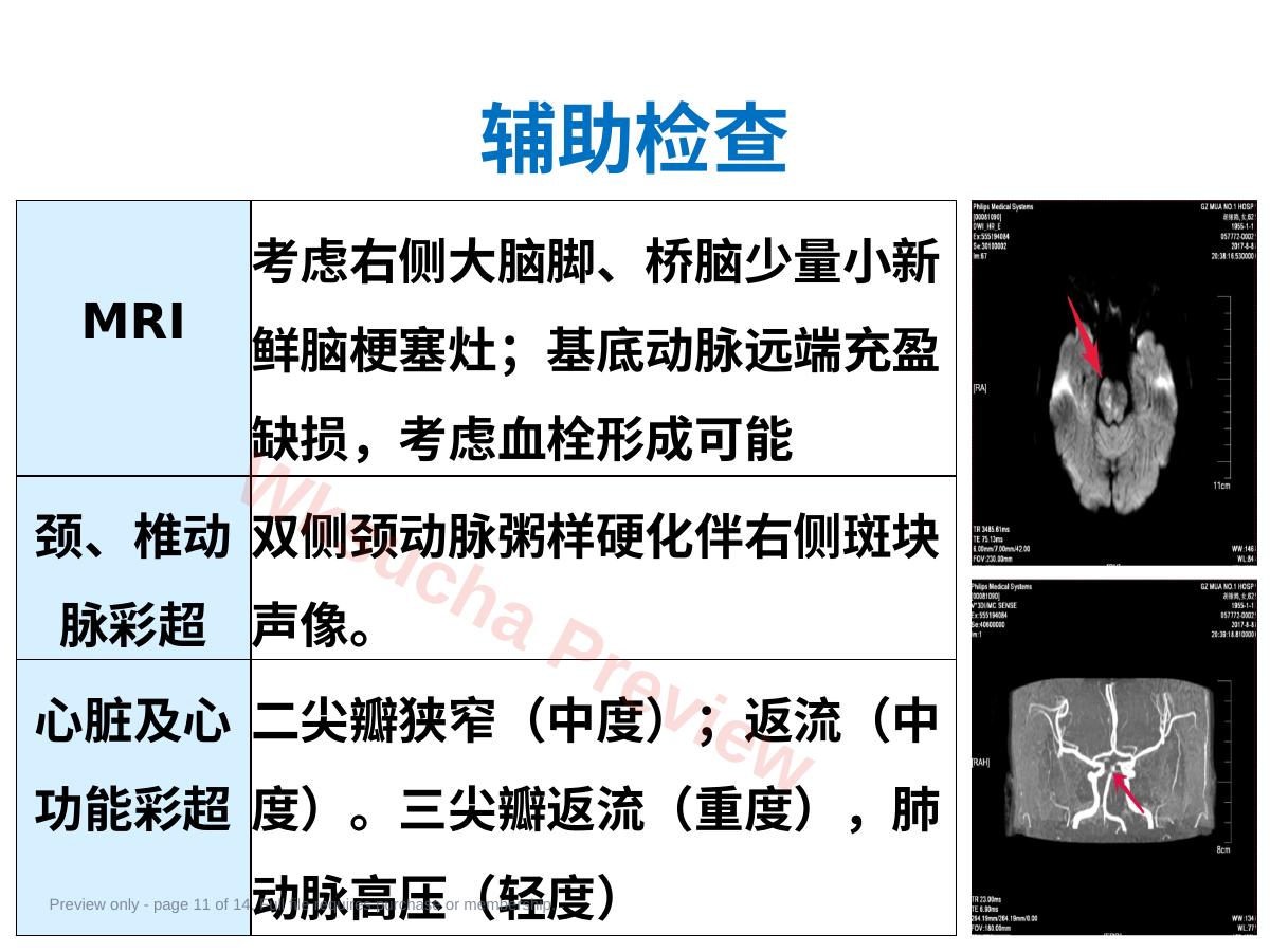 预览第 11 页