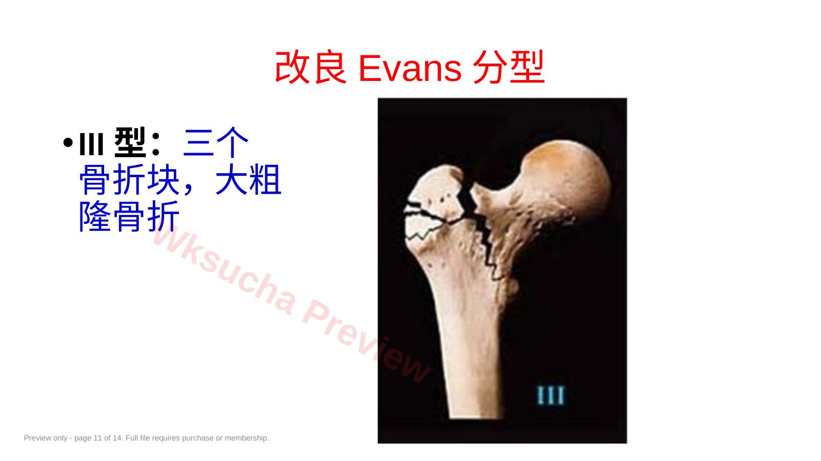 预览第 11 页