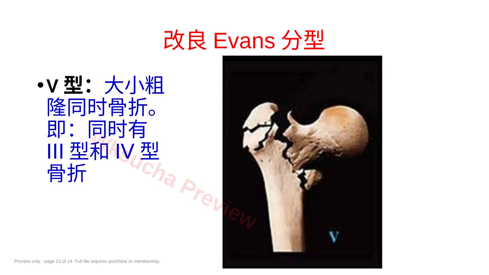 预览第 13 页