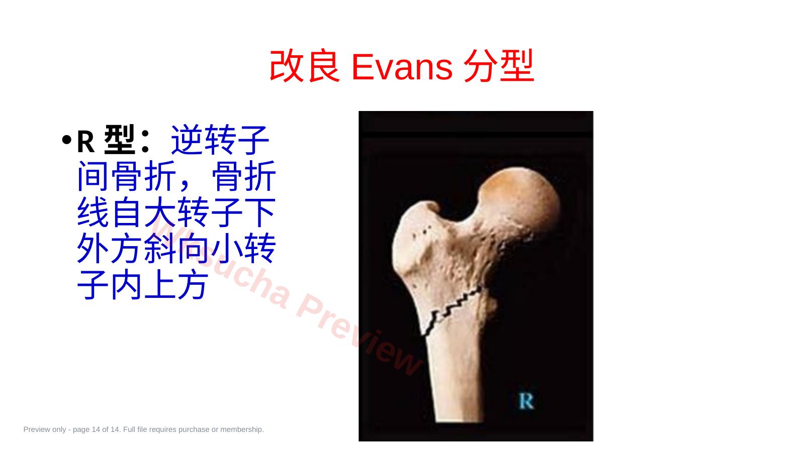 预览第 14 页