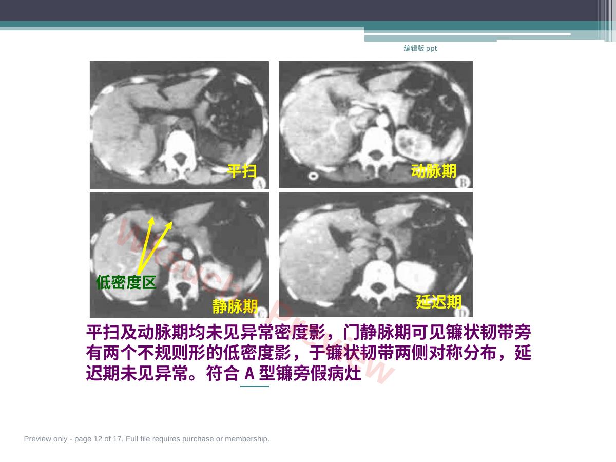 预览第 12 页